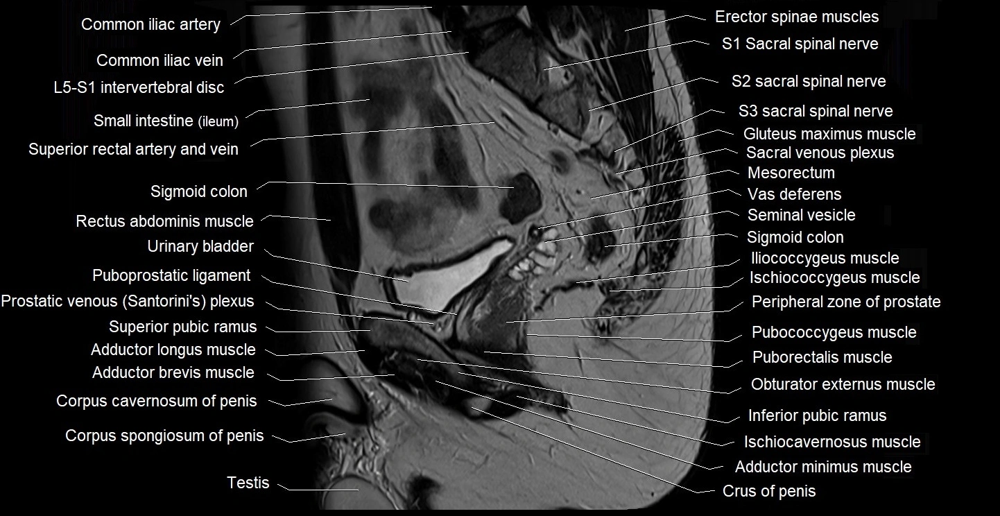 male pelvis sagittal cross sectional anatomy 3T mri image 19.webp